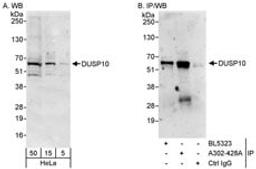 Detection of human DUSP10 by western blot and immunoprecipitation.