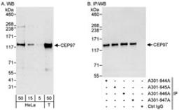 Detection of human CEP97 by western blot and immunoprecipitation.