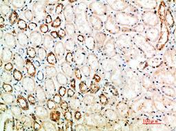 Immunohistochemical analysis of paraffin-embedded human-kidney, antibody was diluted at 1:200