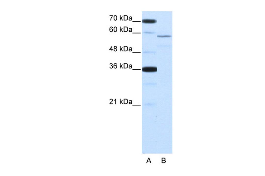 Antibody used in WB on Human HepG2 at 2.5 ug/ml.