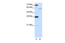 Antibody used in WB on Human HepG2 at 2.5 ug/ml.