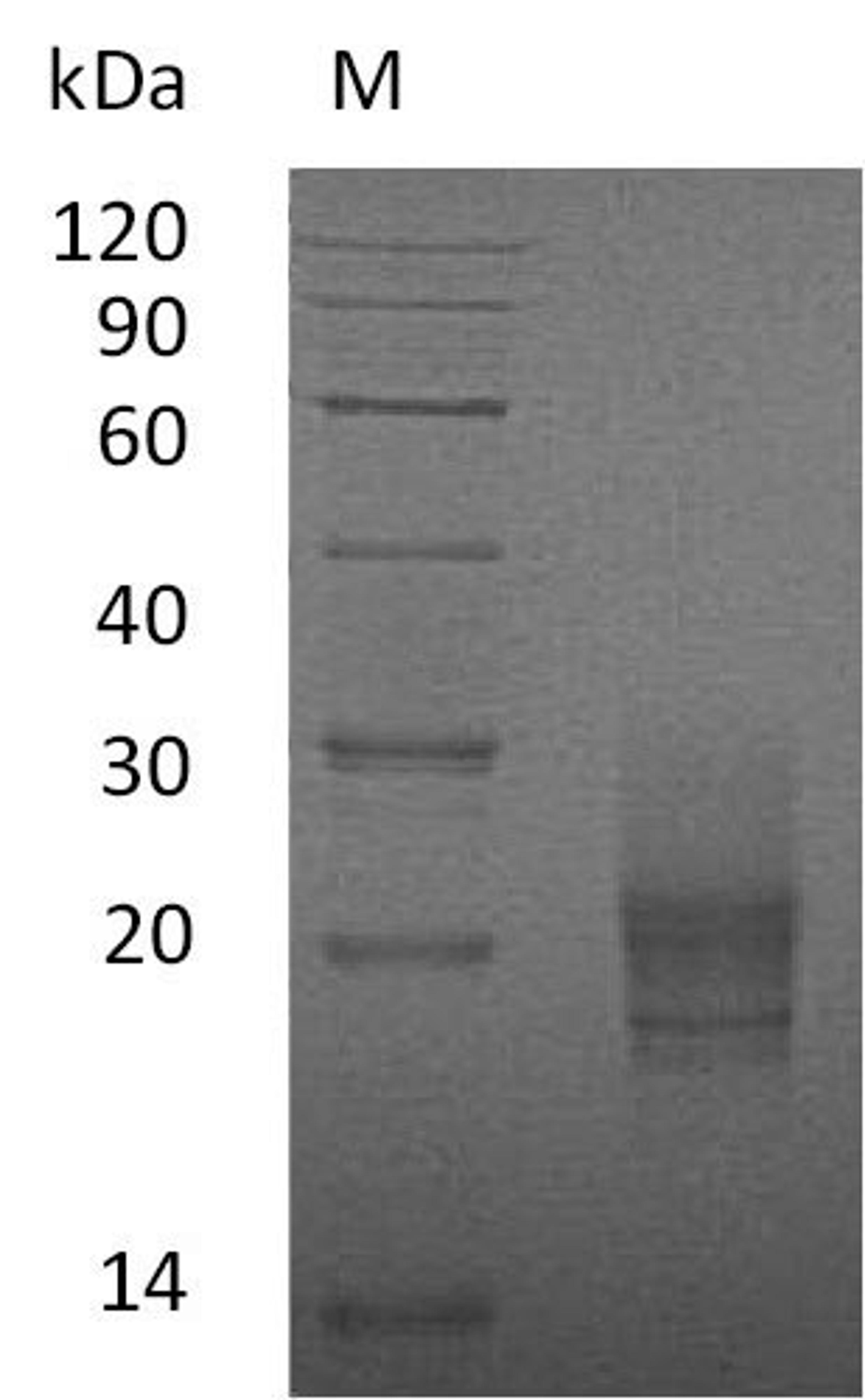 (Tris-Glycine gel) Discontinuous SDS-PAGE (reduced) with 5% enrichment gel and 15% separation gel.