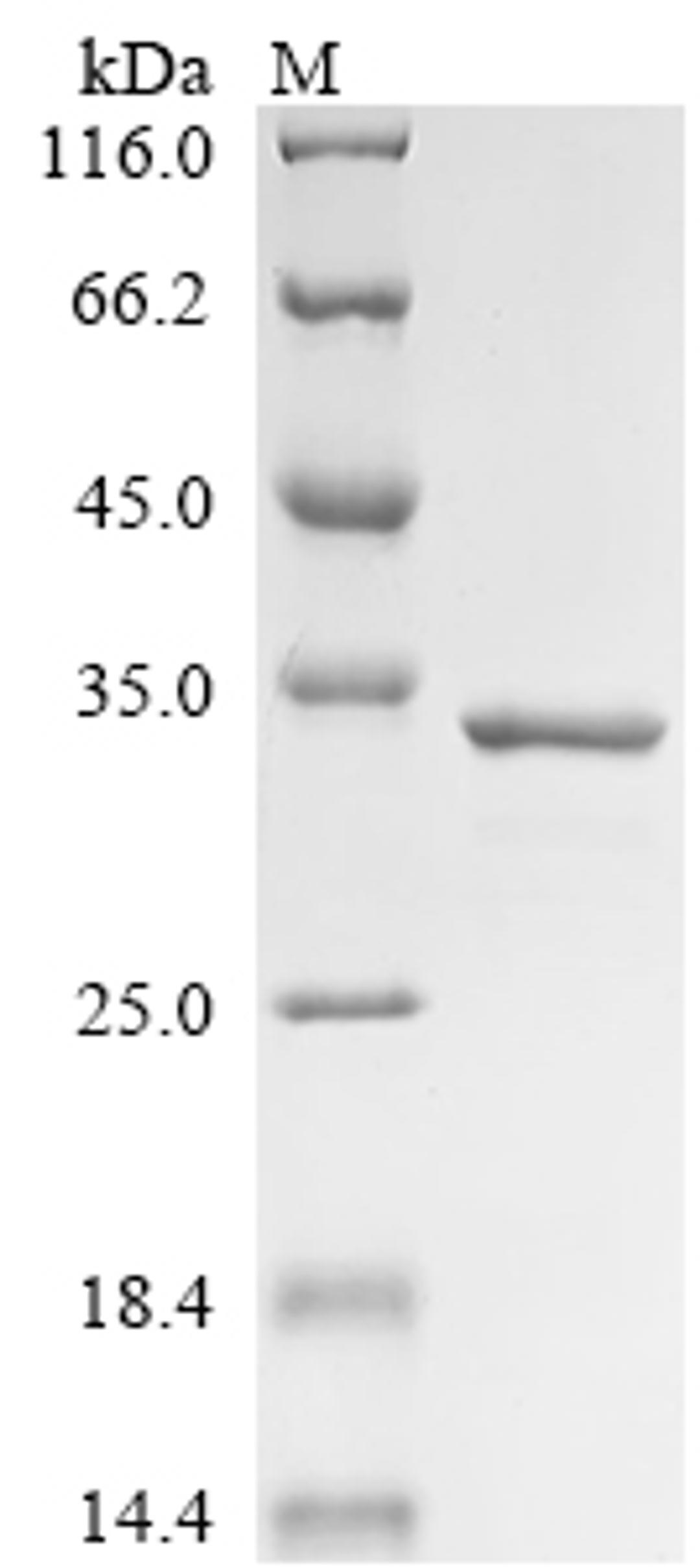 (Tris-Glycine gel) Discontinuous SDS-PAGE (reduced) with 5% enrichment gel and 15% separation gel.