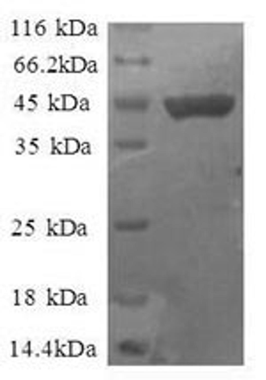 (Tris-Glycine gel) Discontinuous SDS-PAGE (reduced) with 5% enrichment gel and 15% separation gel.