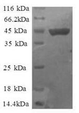 (Tris-Glycine gel) Discontinuous SDS-PAGE (reduced) with 5% enrichment gel and 15% separation gel.