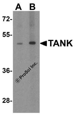 Western blot analysis of TANK in human kidney tissue lysate with TANK antibody at (A) 1 and (B) 2 μg/mL.