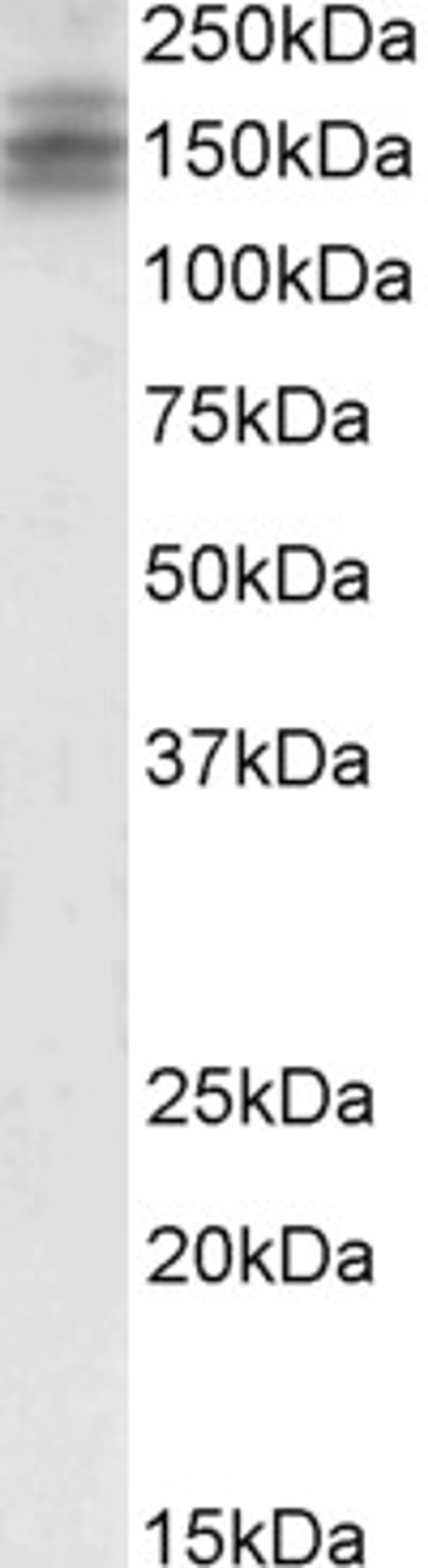 45-499 (2ug/ml) staining of Human Brain (Cerebellum) lysate (35ug protein in RIPA buffer). Primary incubation was 1 hour. Detected by chemiluminescence.