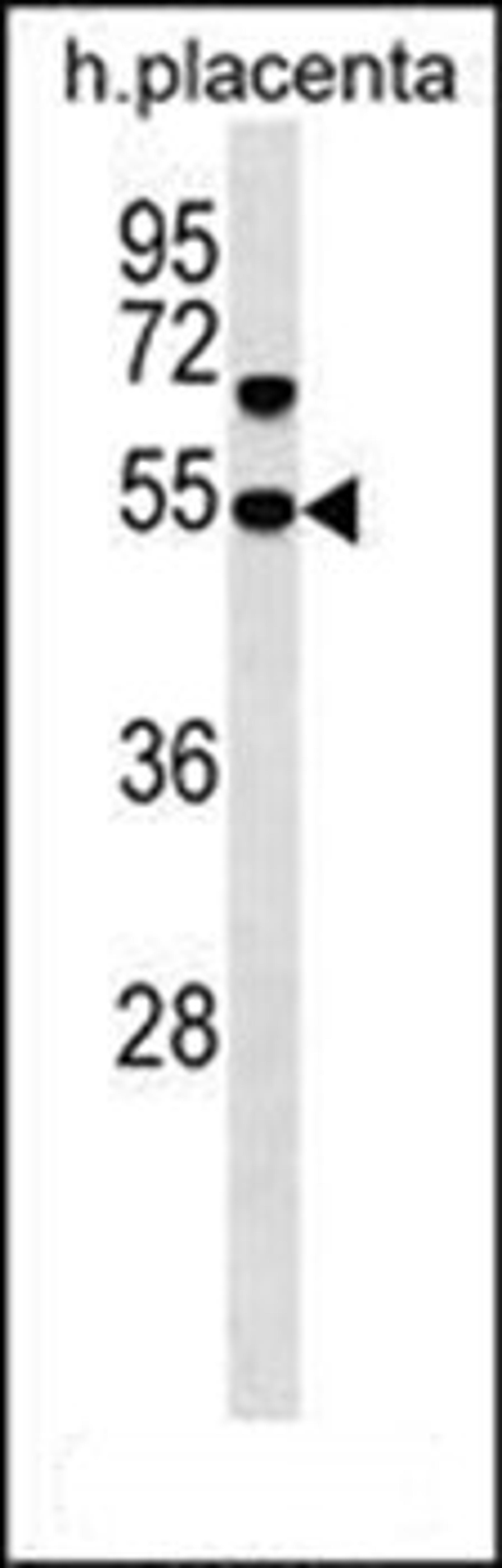 Western blot analysis of human placenta tissue lysates (35ug/lane) using SNX30 antibody (C-term)