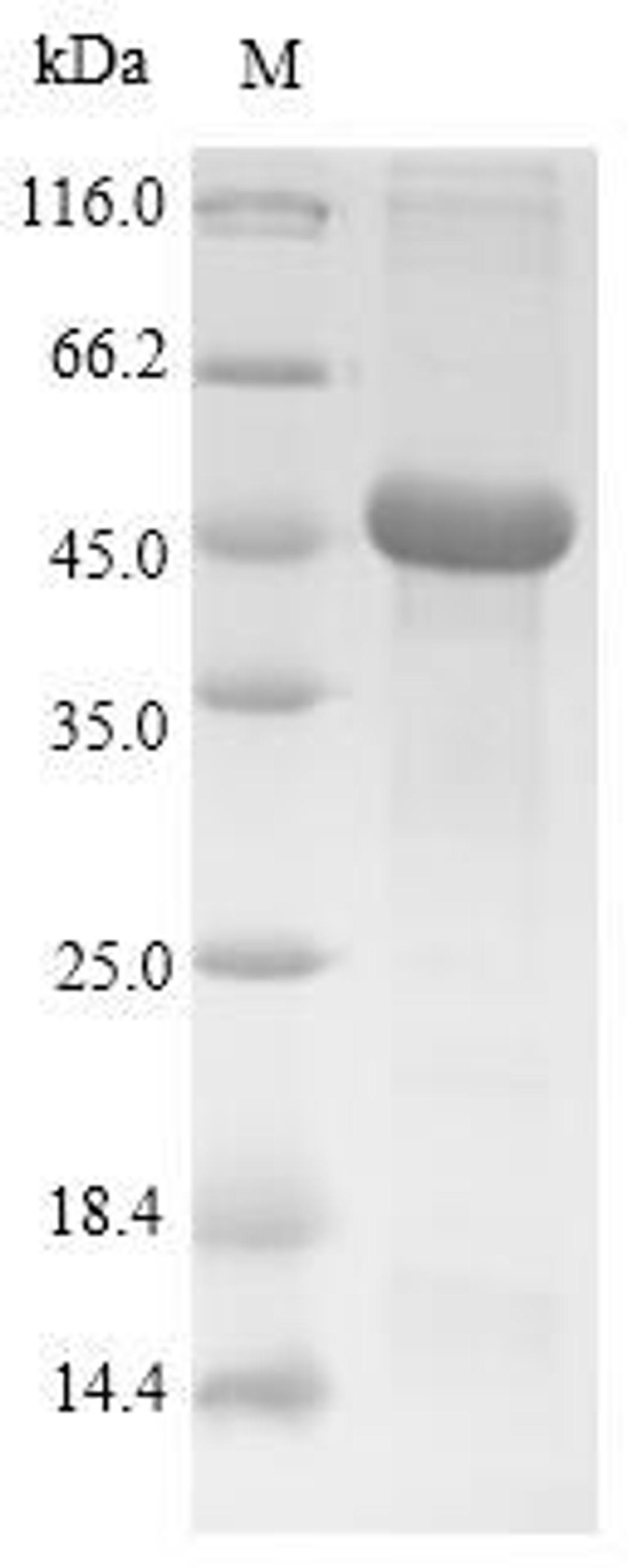 (Tris-Glycine gel) Discontinuous SDS-PAGE (reduced) with 5% enrichment gel and 15% separation gel.
