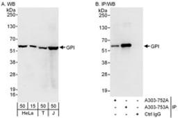 Detection of human GPI by western blot and immunoprecipitation.