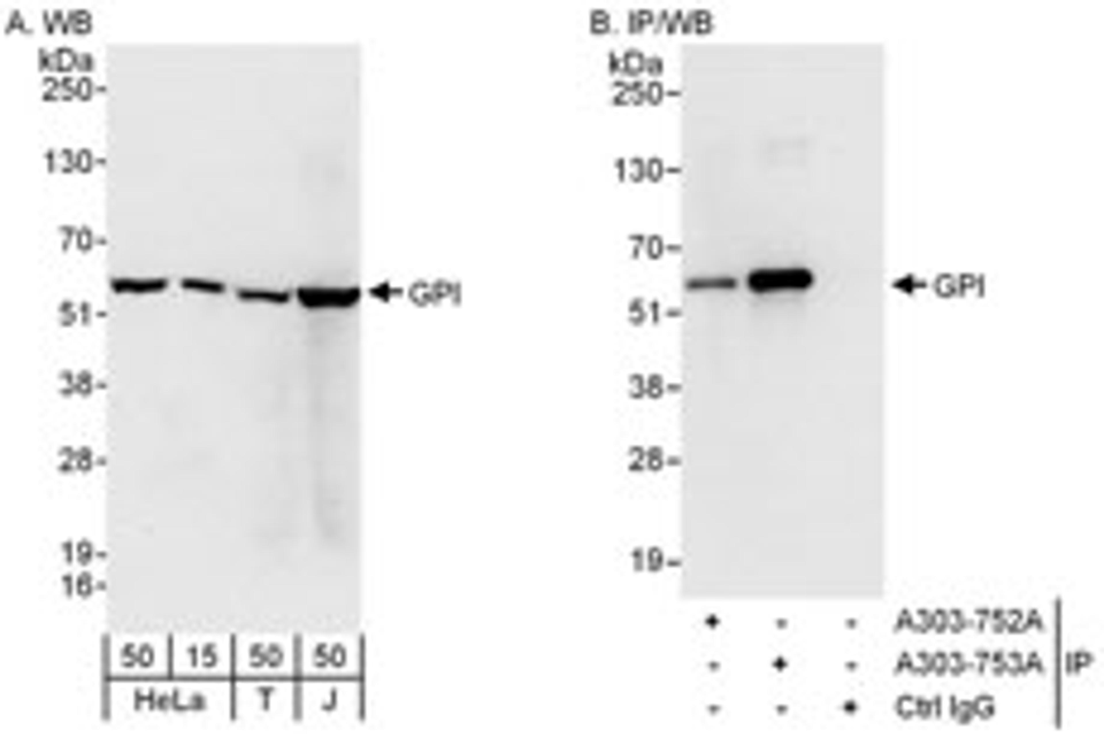 Detection of human GPI by western blot and immunoprecipitation.