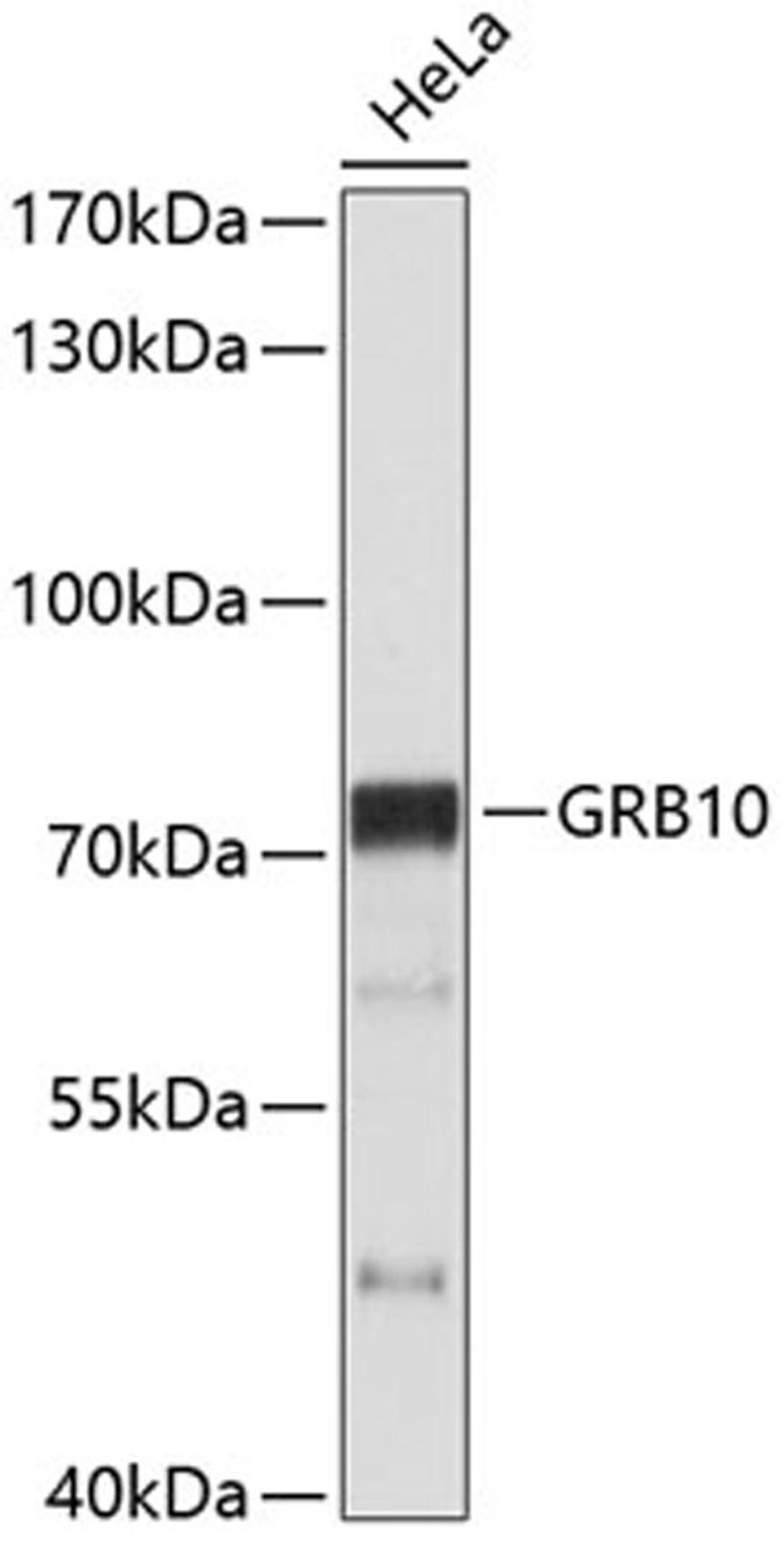 Western blot - GRB10 antibody (A0634)