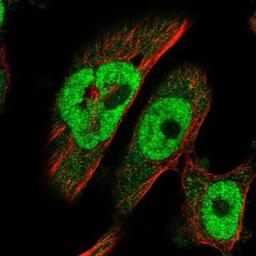 Immunocytochemistry/Immunofluorescence: BRCA2 Antibody [NBP1-88361] - Staining of human cell line U-251MG shows positivity in nucleus but not nucleoli & cytoplasm.