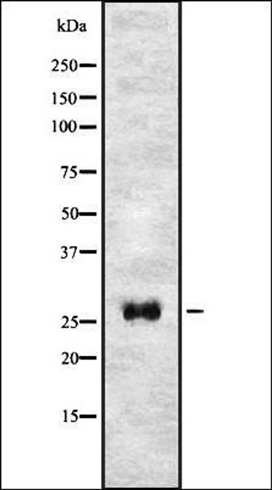 Western blot analysis of HEK293 cells using T106C antibody