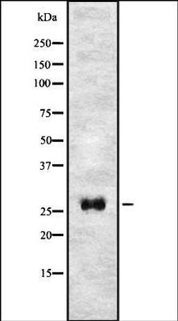 Western blot analysis of HEK293 cells using T106C antibody