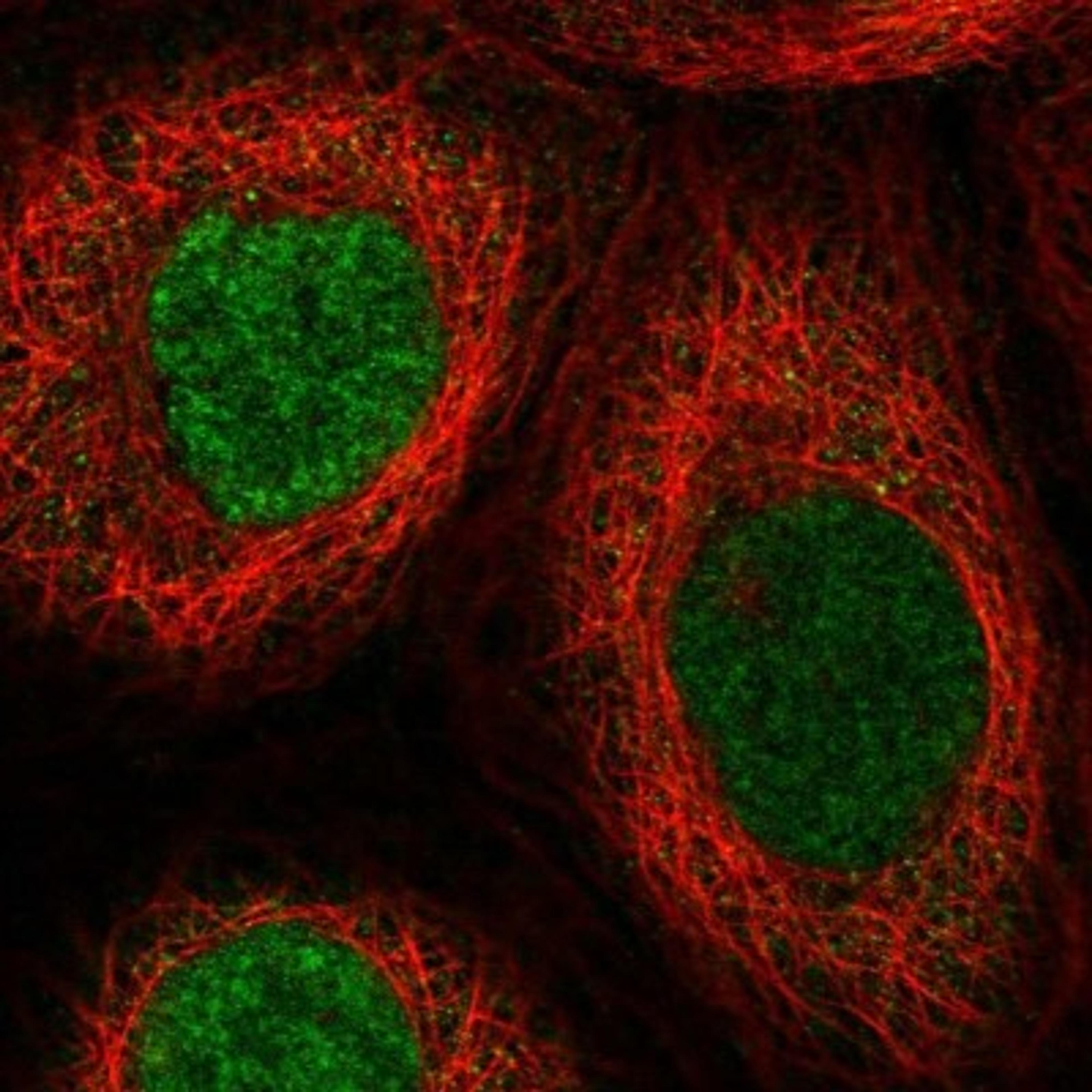 Immunofluorescence: DFF45/ICAD Antibody [NBP1-85248] - Staining of human cell line A-431 shows positivity in nucleus but not nucleoli & cytoplasm.