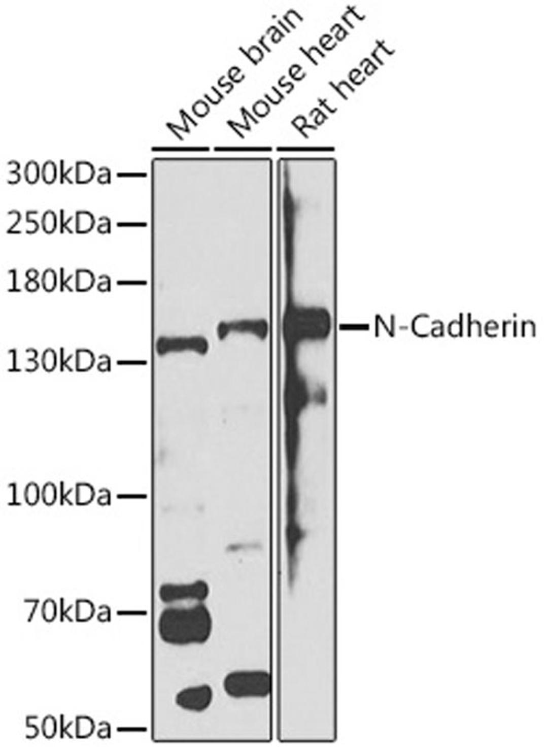 Western blot - N-Cadherin antibody (A0432)