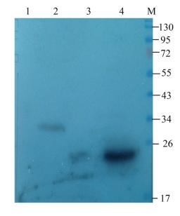 WB analysis of mouse spinal cord (lane 1), mouse pancreas (lane 2), mouse kidney (lane 3), rat liver (lane 4) using CLEC1B antibody (1 ug/ml)