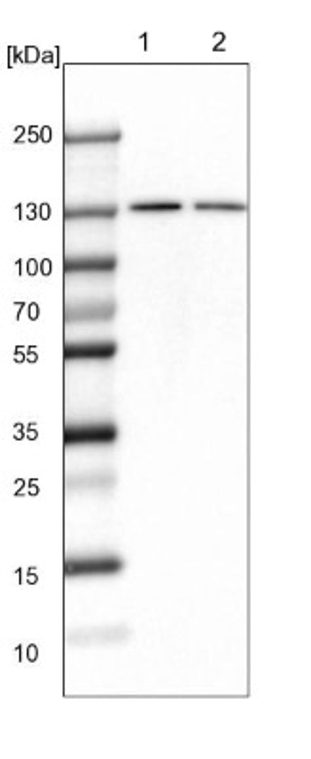 Western Blot: FBP2 Antibody [NBP1-88113] - Lane 1: NIH-3T3 cell lysate (Mouse embryonic fibroblast cells)<br/>Lane 2: NBT-II cell lysate (Rat Wistar bladder tumour cells)