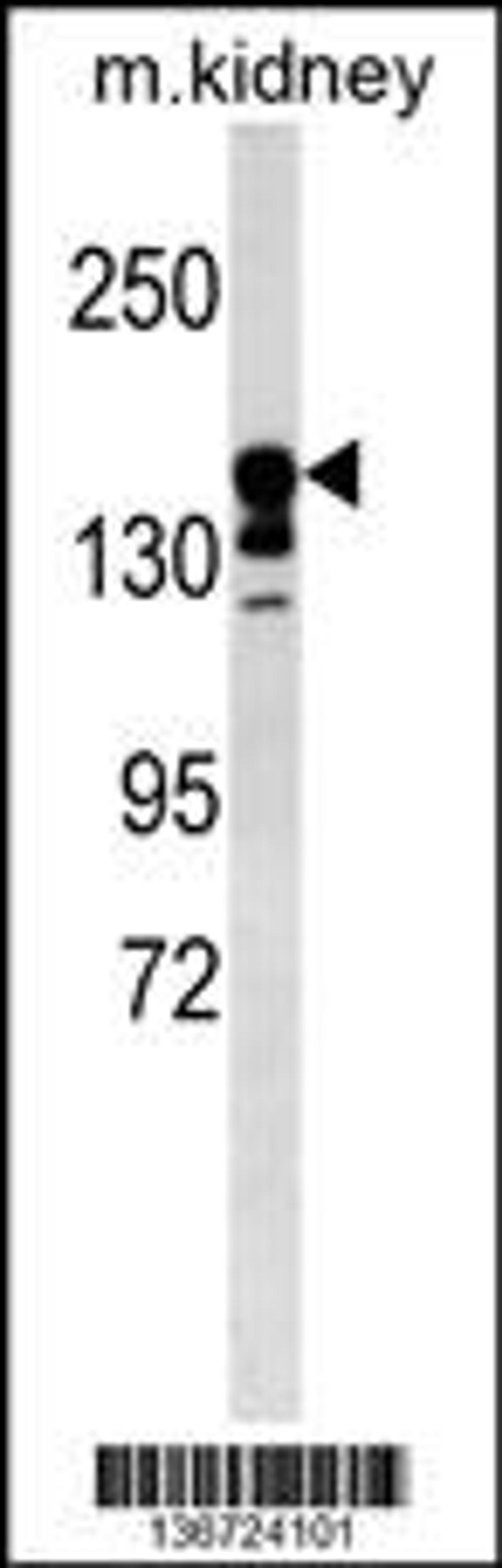 Western blot analysis in mouse kidney tissue lysates (35ug/lane).