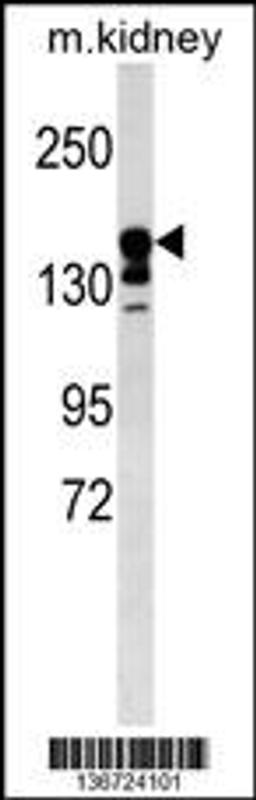 Western blot analysis in mouse kidney tissue lysates (35ug/lane).