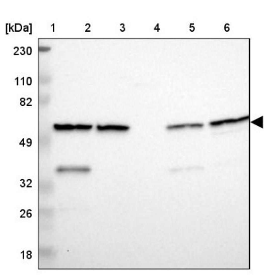 Western Blot: FARSLA Antibody [NBP1-88067] - Lane 1: Marker [kDa] 230, 110, 82, 49, 32, 26, 18<br/>Lane 2: Human cell line RT-4<br/>Lane 3: Human cell line U-251MG sp<br/>Lane 4: Human plasma (IgG/HSA depleted)<br/>Lane 5: Human liver tissue<br/>Lane 6: Human tonsil tissue