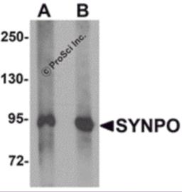 Western blot analysis of SYNPO in rat brain tissue lysate with SYNPO antibody at (A) 1 and (B) 2 &#956;g/mL.