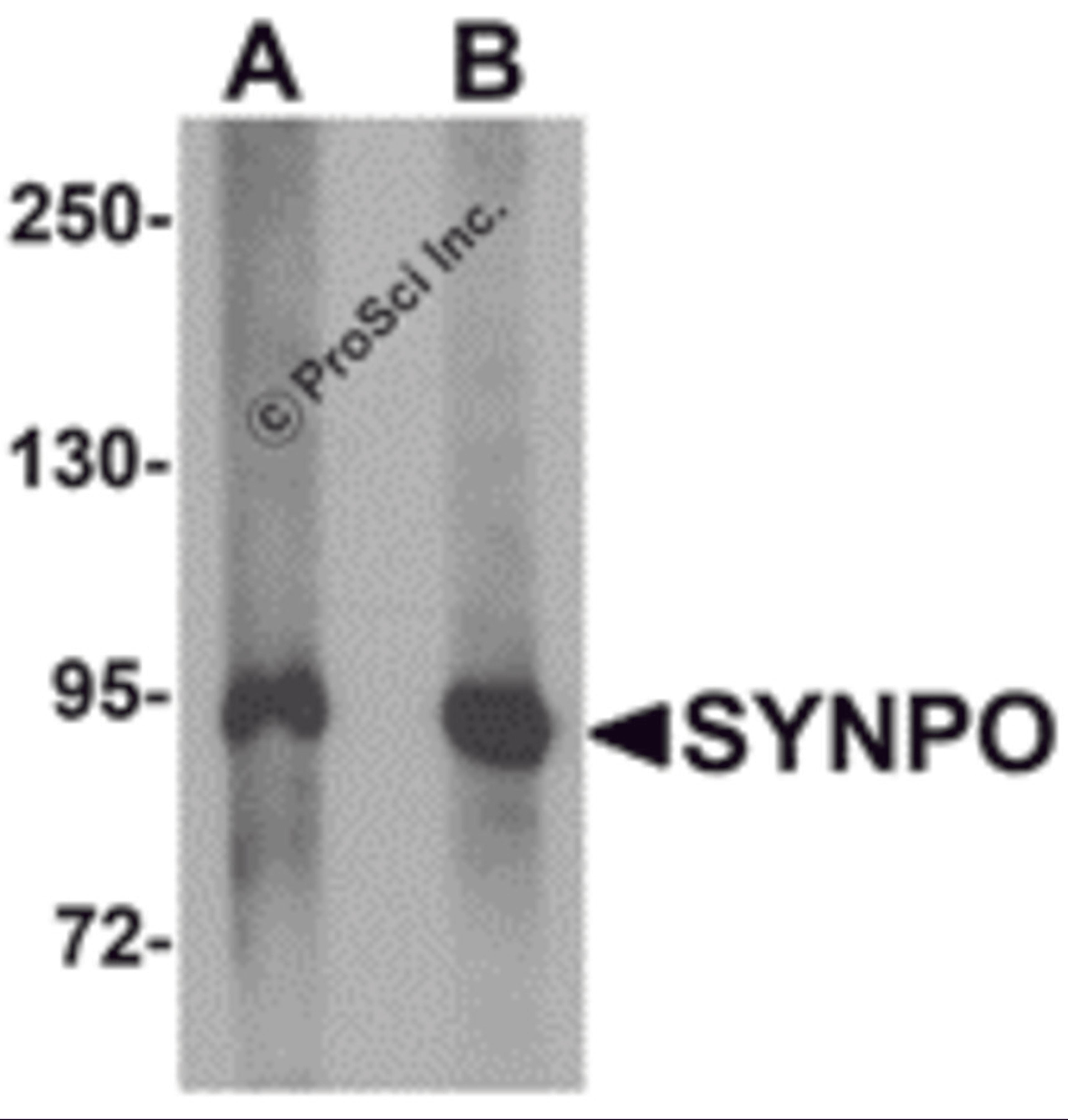 Western blot analysis of SYNPO in rat brain tissue lysate with SYNPO antibody at (A) 1 and (B) 2 &#956;g/mL.