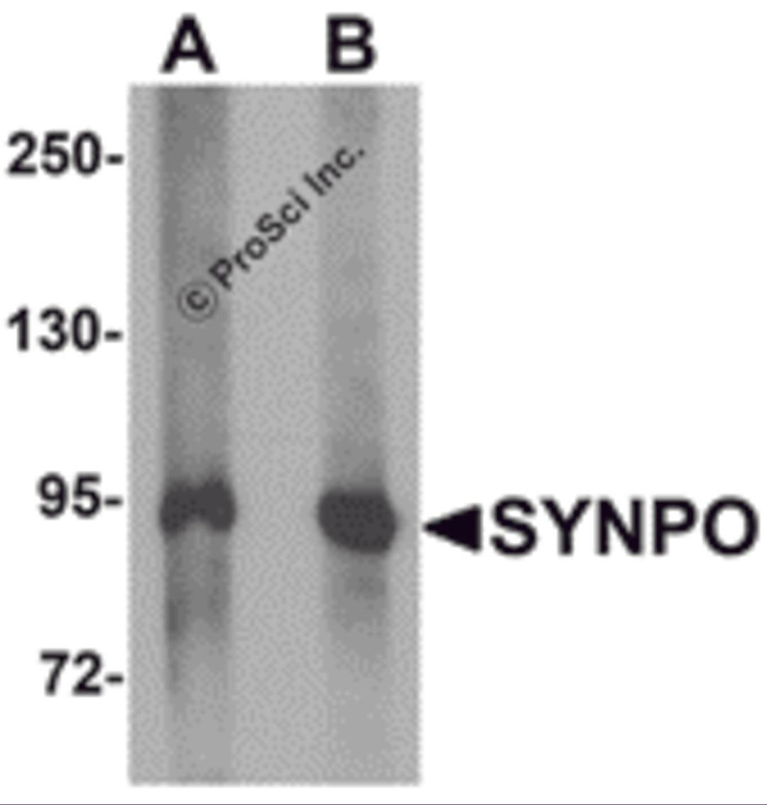 Western blot analysis of SYNPO in rat brain tissue lysate with SYNPO antibody at (A) 1 and (B) 2 μg/mL.