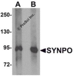 Western blot analysis of SYNPO in rat brain tissue lysate with SYNPO antibody at (A) 1 and (B) 2 μg/mL.