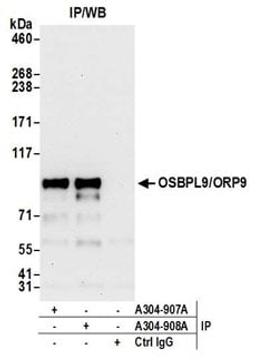 Detection of human OSBPL9/ORP9 by western blot of immunoprecipitates.