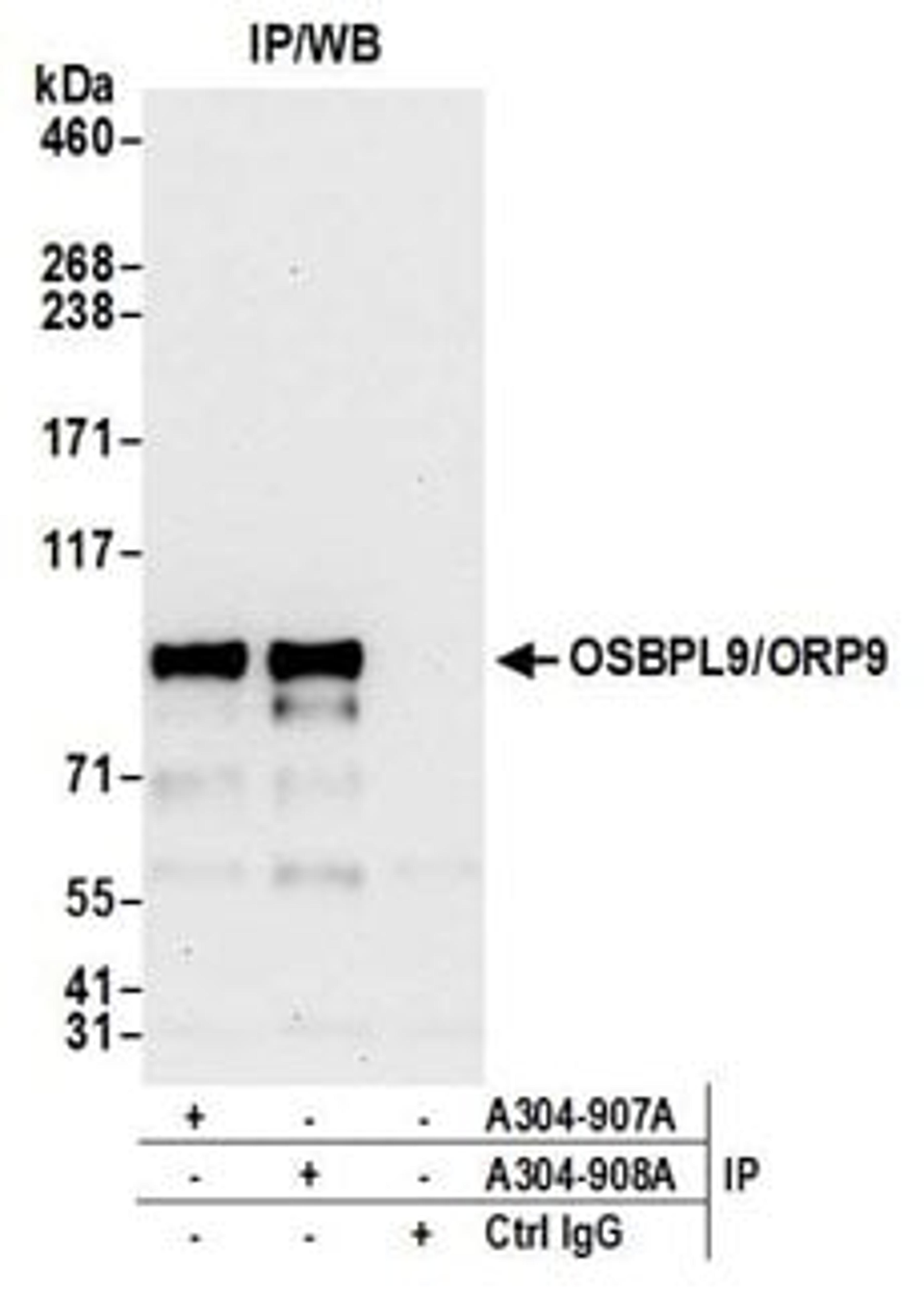 Detection of human OSBPL9/ORP9 by western blot of immunoprecipitates.