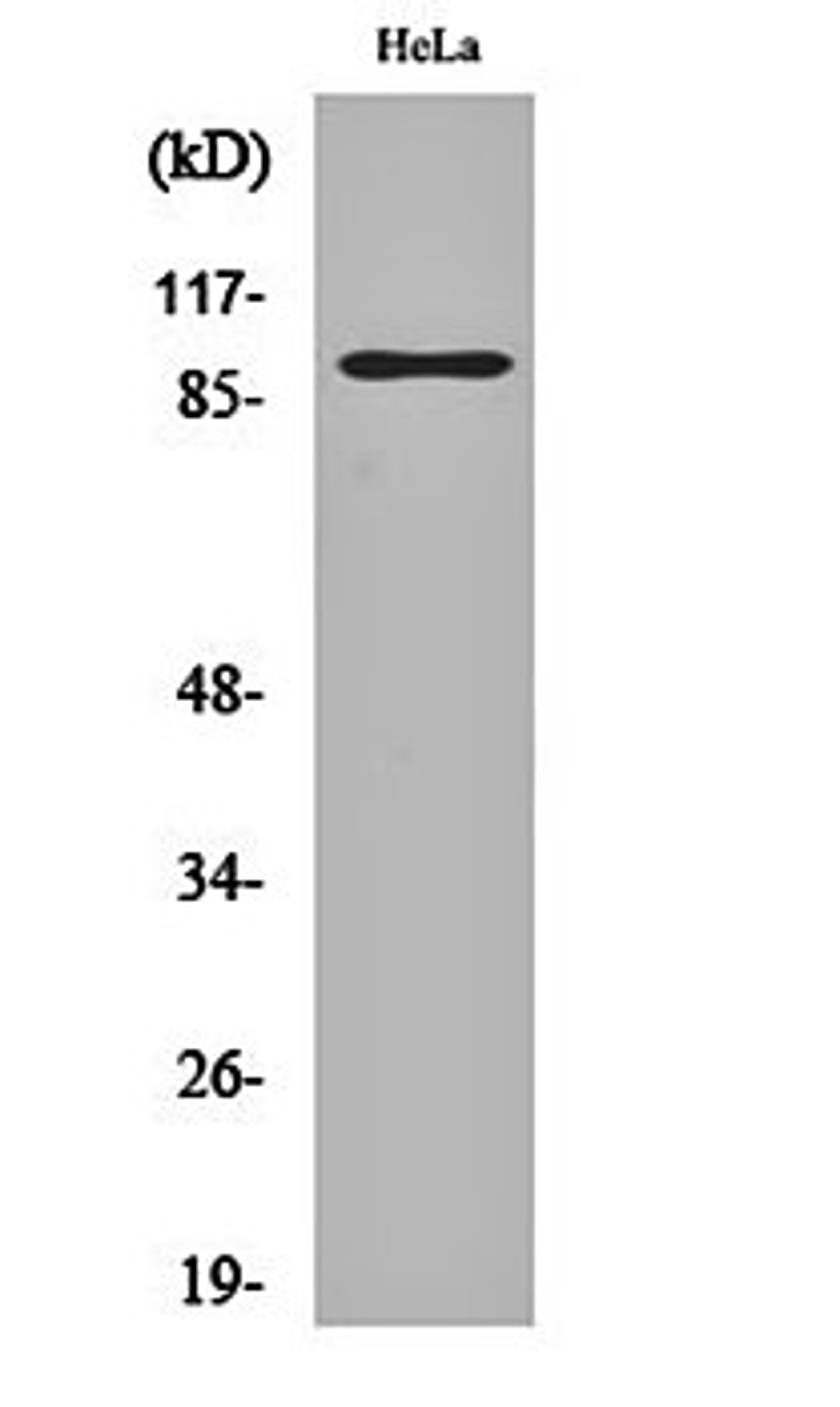 Western blot analysis of Hela cell lysates using PGBD1 antibody