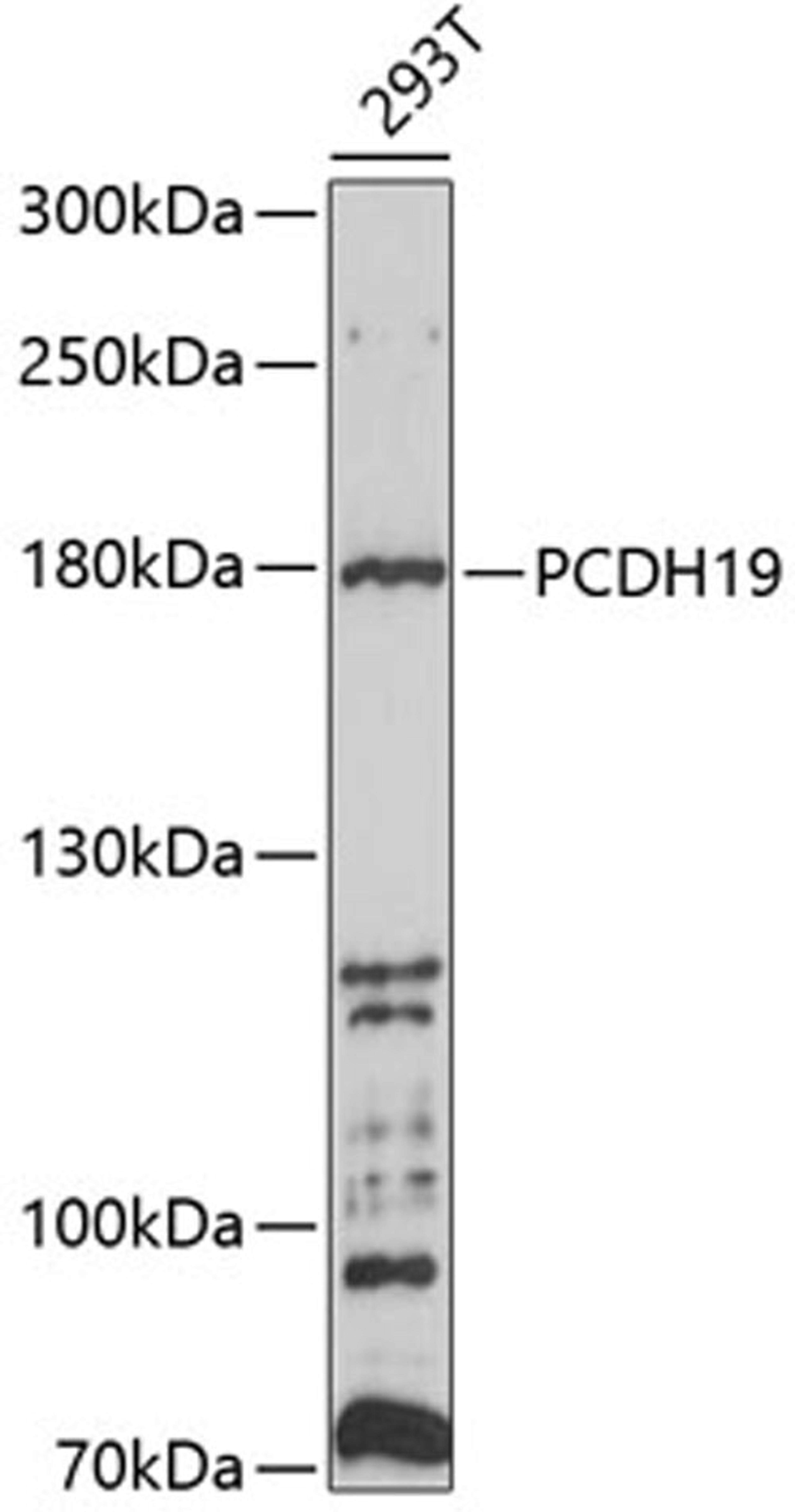 Western blot - PCDH19 antibody (A10067)