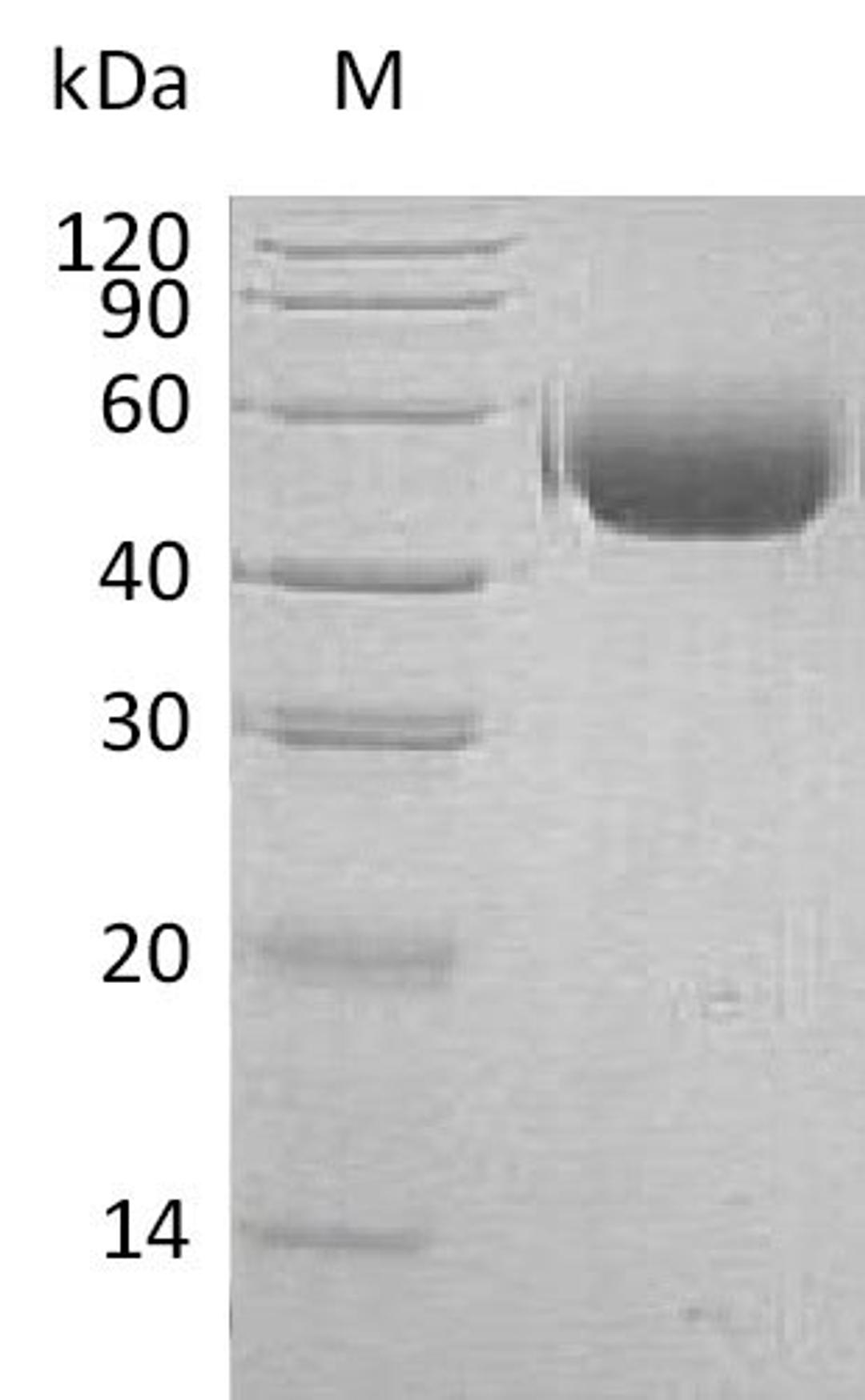(Tris-Glycine gel) Discontinuous SDS-PAGE (reduced) with 5% enrichment gel and 15% separation gel.
