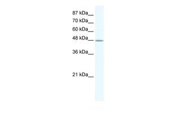 Antibody used in WB on Human HepG2 at 1.25 ug/ml.