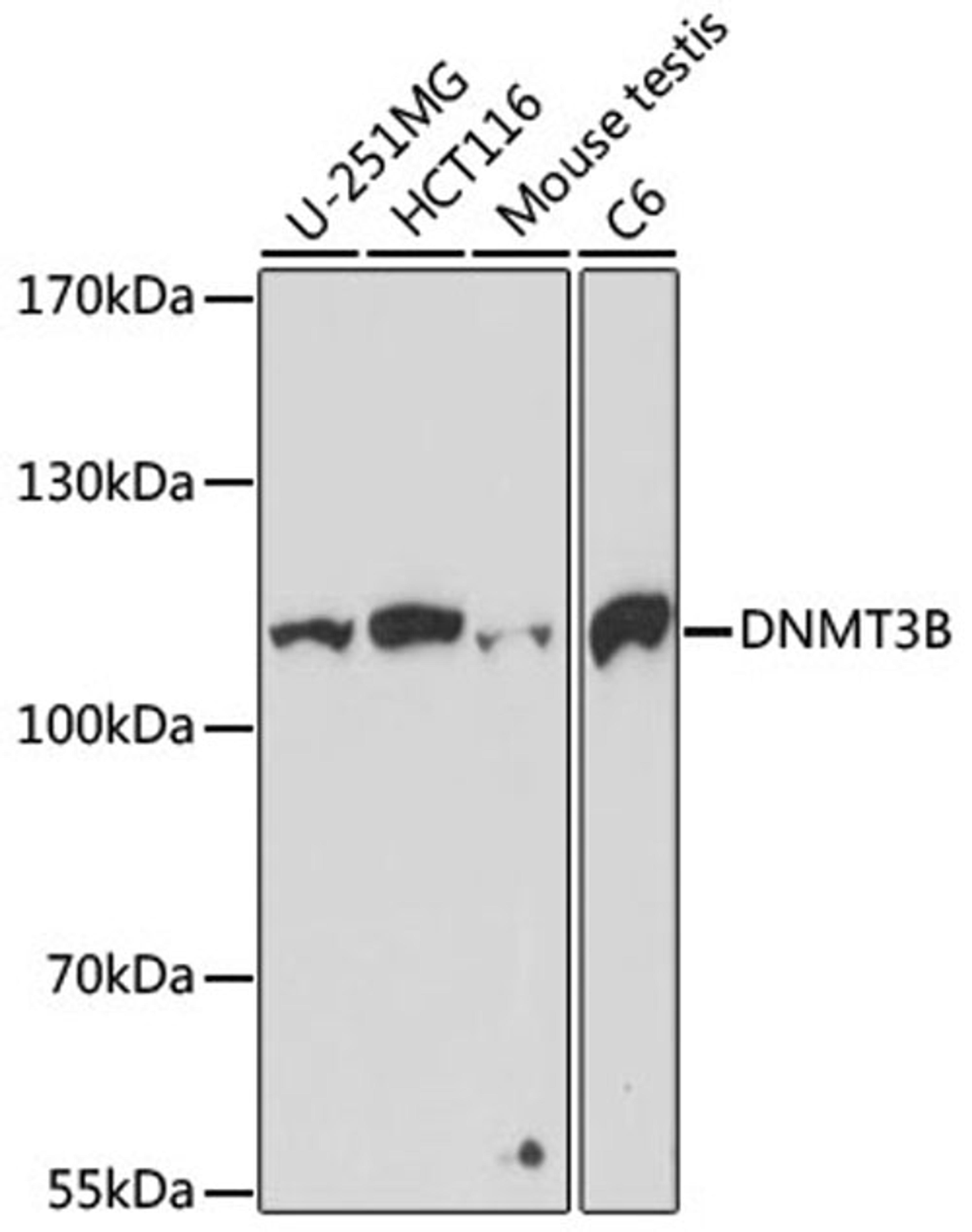 Western blot - DNMT3B antibody (A2899)