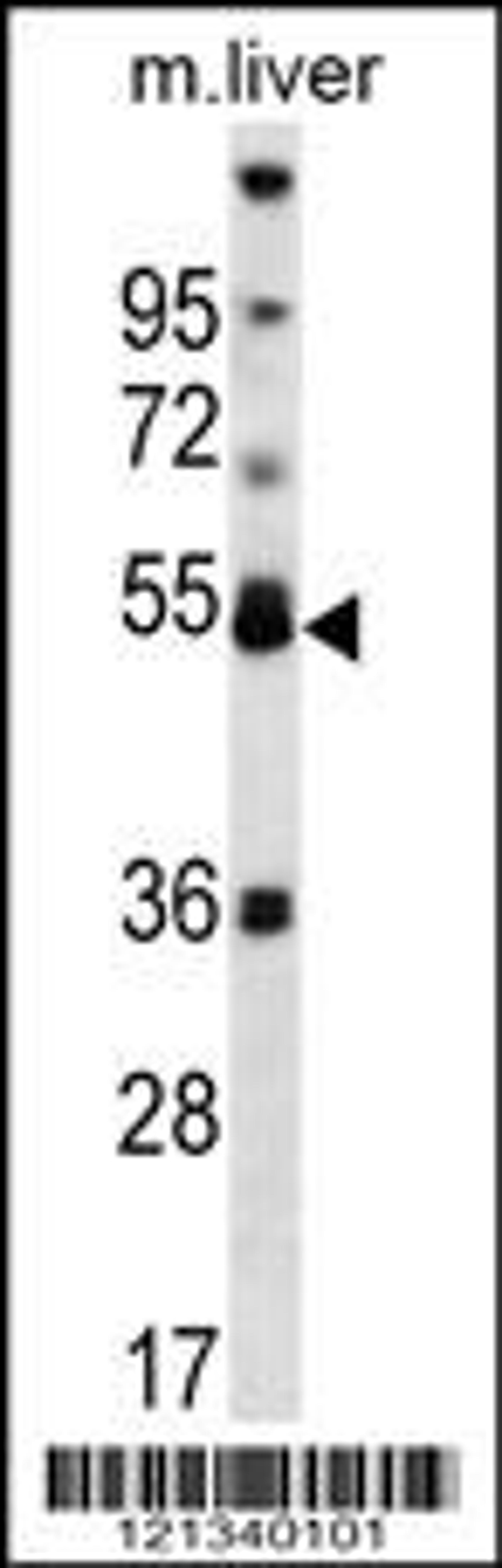 Western blot analysis in mouse liver tissue lysates (35ug/lane).