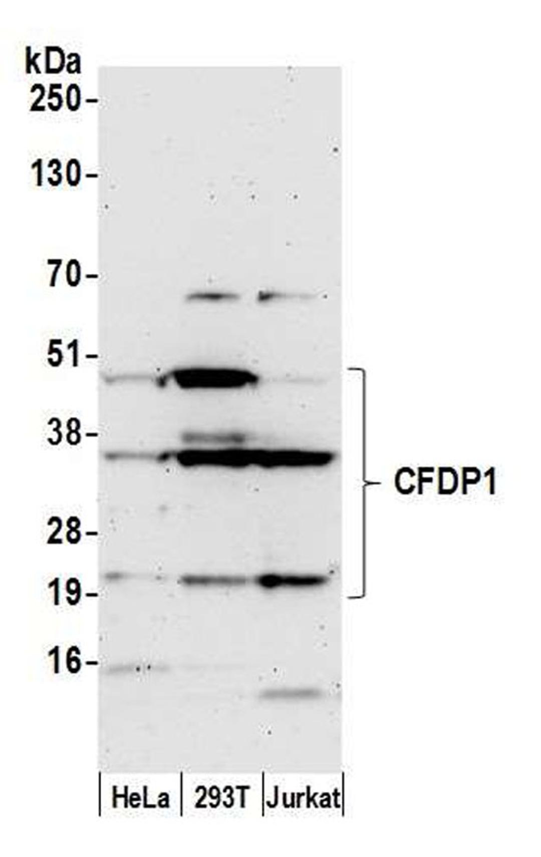 Detection of human CFDP1 by WB.