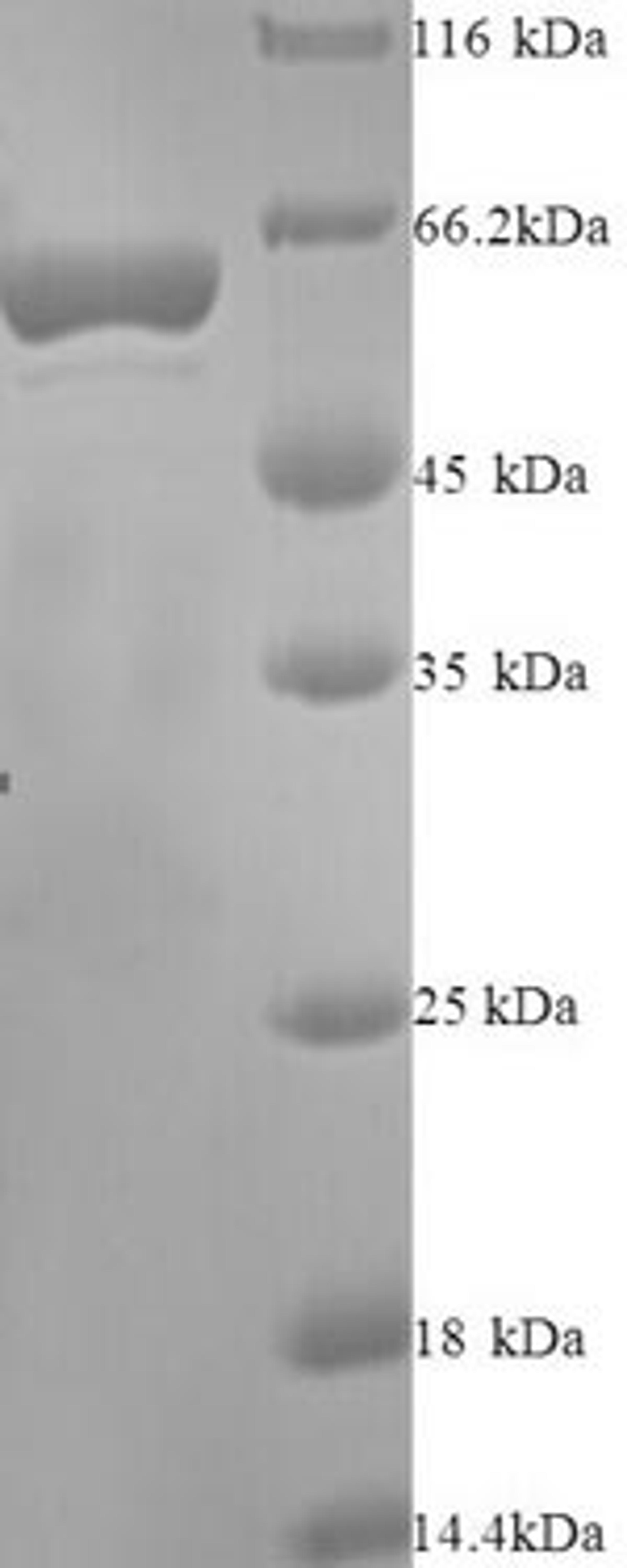 (Tris-Glycine gel) Discontinuous SDS-PAGE (reduced) with 5% enrichment gel and 15% separation gel.