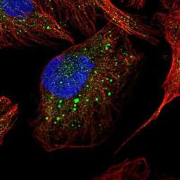 Immunocytochemistry/Immunofluorescence: Cathepsin A Antibody [NBP1-89728] Staining of human cell line U-2 OS shows positivity in vesicles.