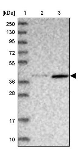 Western Blot: ABLIM1 Antibody [NBP1-89303] - Lane 1: Marker [kDa] 250, 130, 95, 72, 55, 36, 28, 17, 10<br/>Lane 2: Human cell line RT-4<br/>Lane 3: Human cell line U-251MG sp