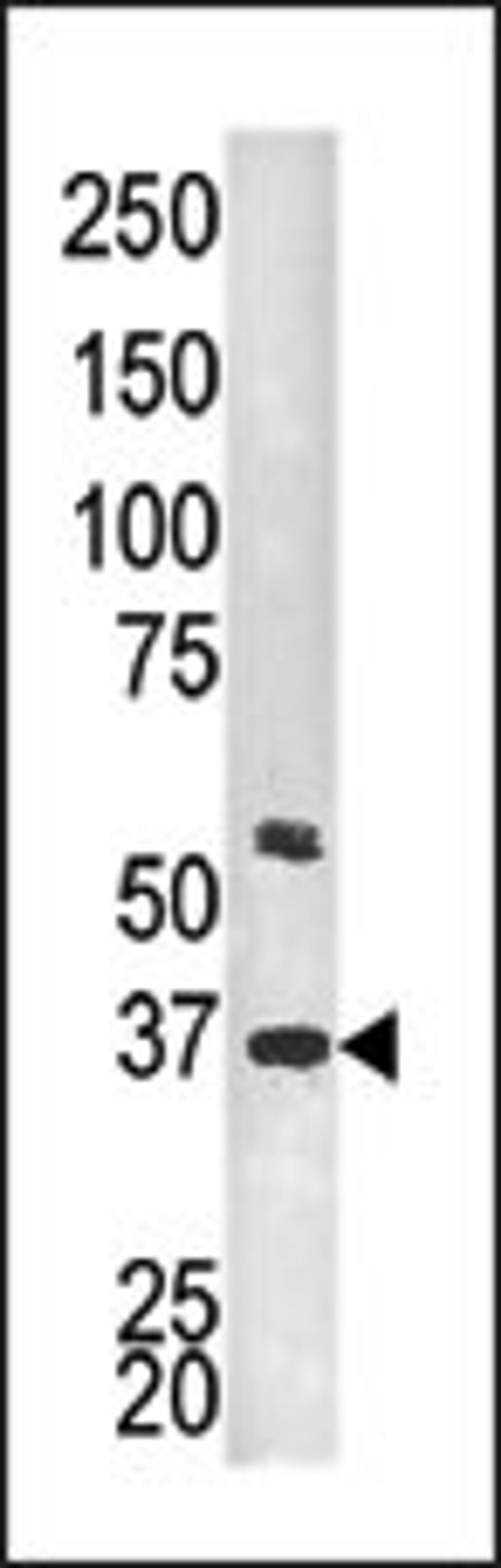 Antibody is used in Western blot to detect PTK9L in HEPG2 tissue lysate.