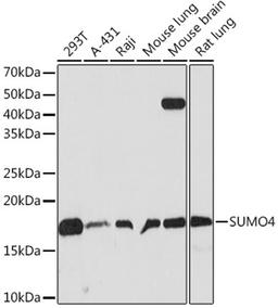 Western blot - SUMO4 Rabbit mAb (A9016)