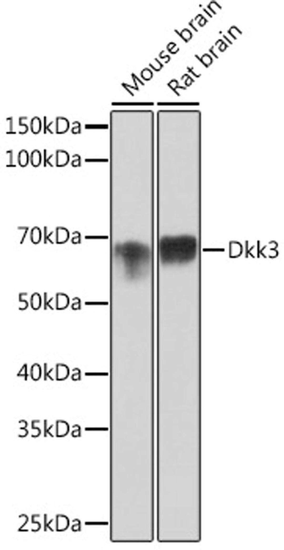 Western blot - Dkk3 Rabbit mAb (A3892)