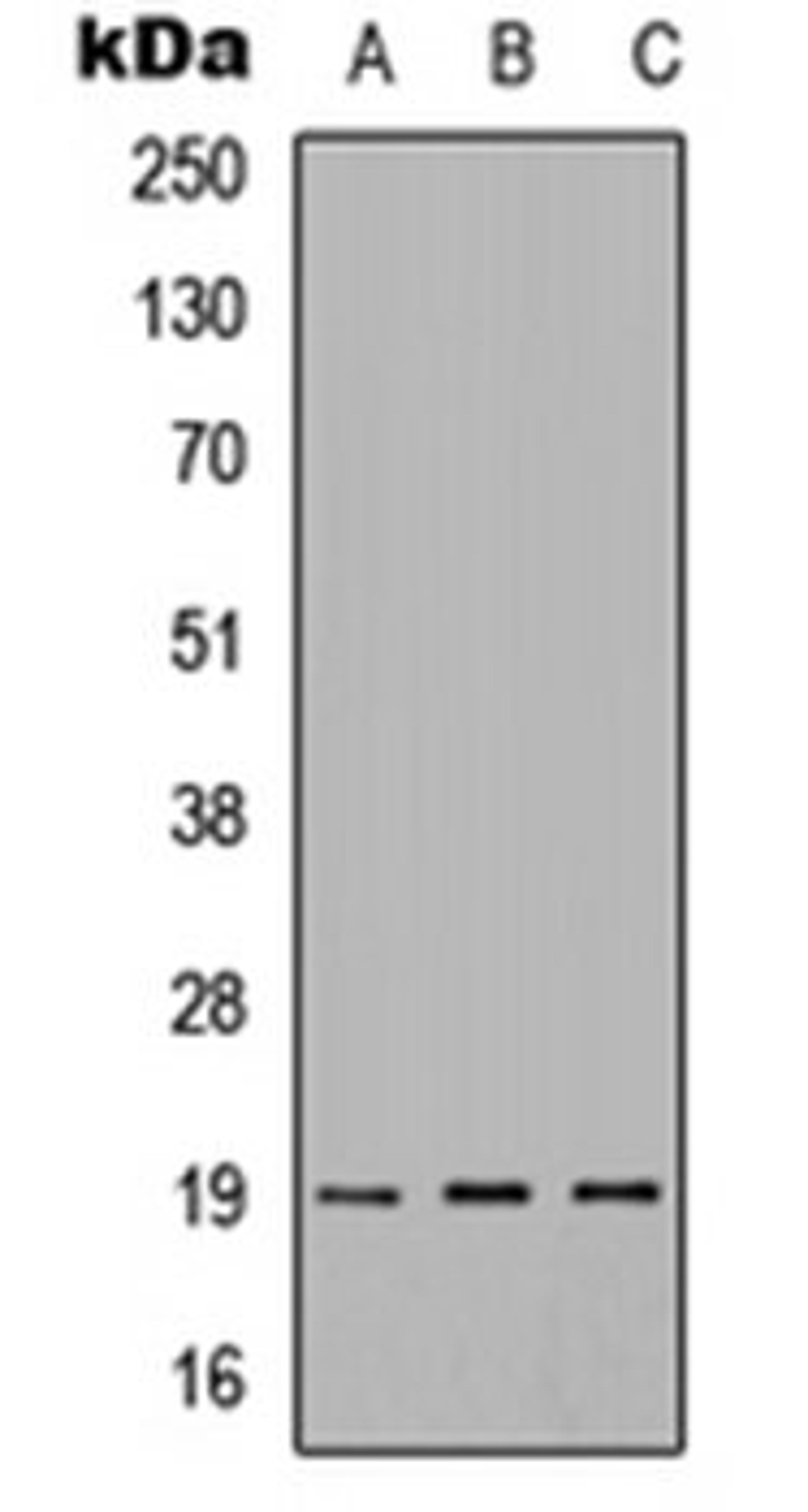 Western blot analysis of HEK293T (Lane 1), Raw264.7 (Lane 2), PC12 (Lane 3) whole cell lysates using IMMP1L antibody