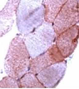 Immunohistochemistry-Paraffin: Dysferlin Antibody [NB120-15109] - Human skeletal muscle