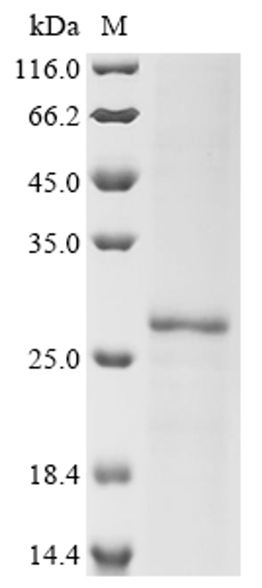 (Tris-Glycine gel) Discontinuous SDS-PAGE (reduced) with 5% enrichment gel and 15% separation gel.