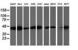 Western Blot: Spermine synthase Antibody (3C9) [NBP2-00900] Analysis of extracts (35ug) from 9 different cell lines by using anti-Spermine synthase monoclonal antibody.