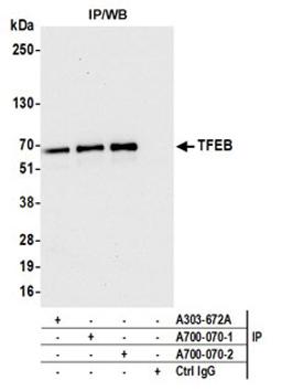 Detection of human TFEB by western blot of immunoprecipitates.